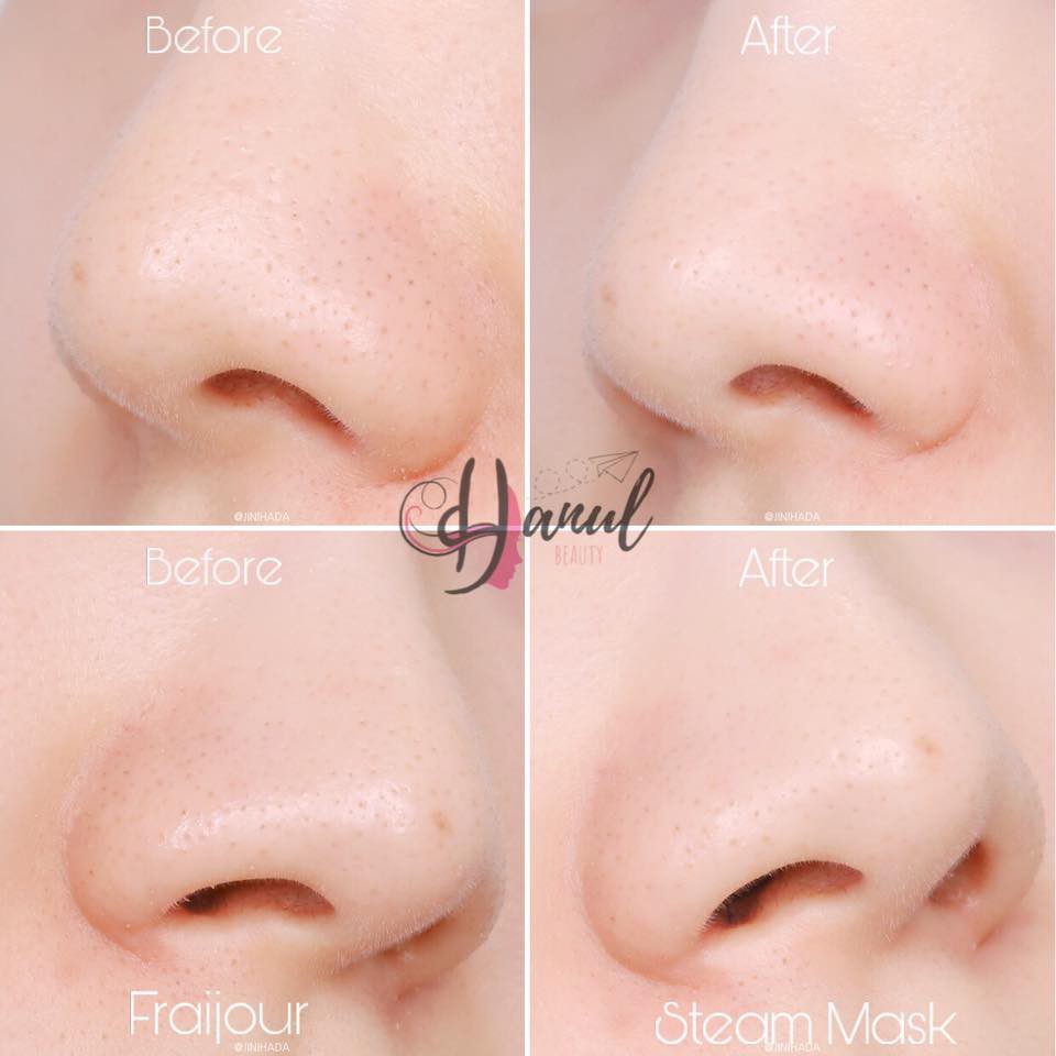 T10.2024 Mặt nạ nóng FRAIJOUR Steam Mask thải độc thanh lọc & làm sáng da chiết xuất từ ngải cứu Hàn Quốc