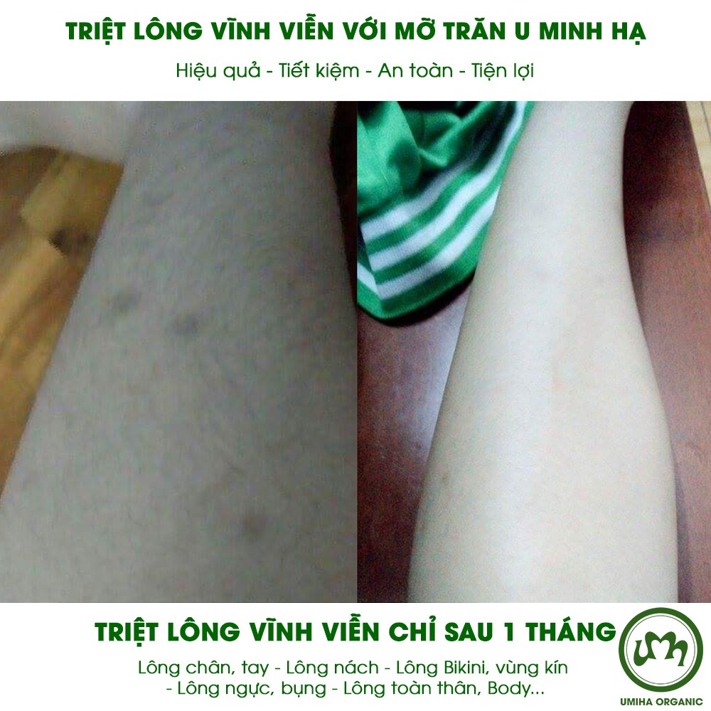 Mỡ trăn triệt lông vĩnh viễn U Minh Hạ (10/30ml) - Dùng cho Bikini, Vùng kín, Chân, Tay, Nách, Body an toàn hiệu quả