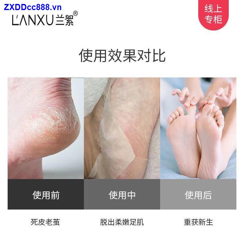 Peeling Foot Mask Hand Mask Whitening Moisturizing and whitening
 [Exfoliating | No. 1 hot sale in our shop] Foot mask, exfoliating calluses, anti-wrinkle foot mask, dry and cracked heel, nourishing and whitening tender feet, exfoliating and peeling foot
