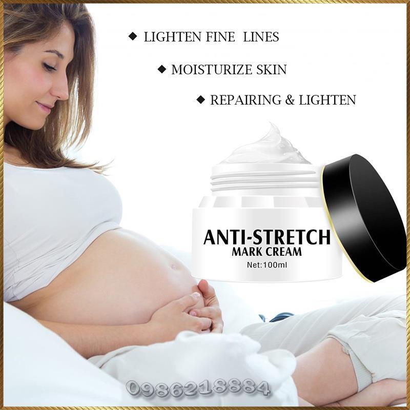 Kem rạn da Aichun Anti-Stretch Mark Cream xóa mờ rạn da A9111