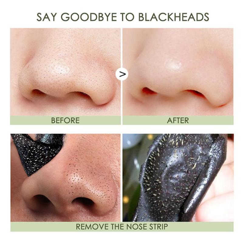 1 miếng dán mũi lột mụn đầu đen Focallure J7B4 | BigBuy360 - bigbuy360.vn