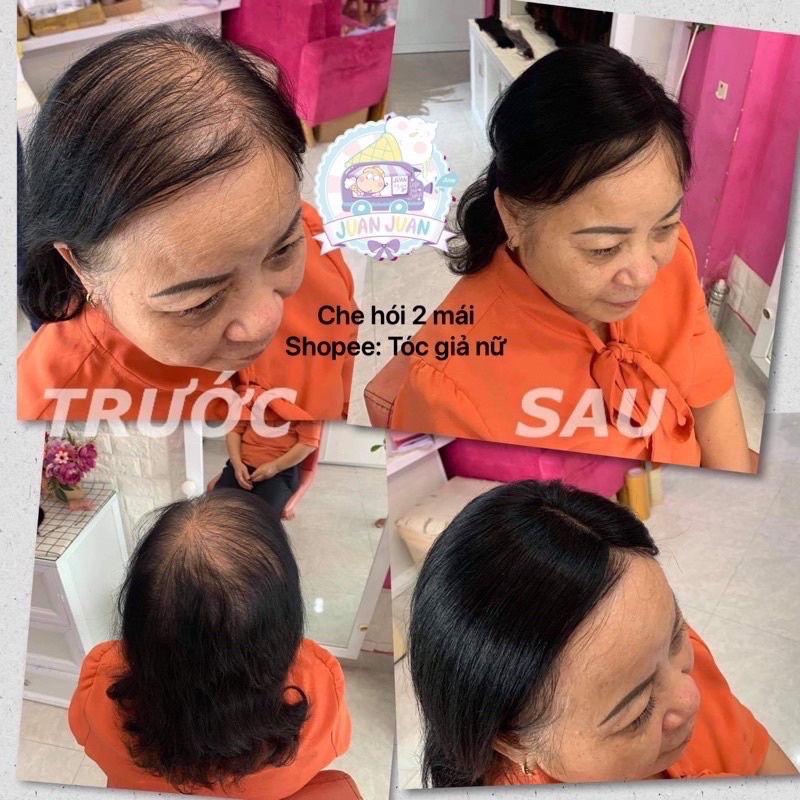 Tóc giả che hói , che bạc phù hợp mọi lứa tuổi 🍀FREESHIP 🍀