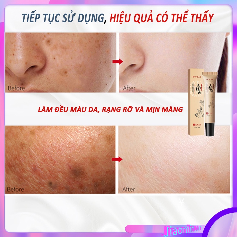Kem Dưỡng Trắng Da Xóa Mờ Sạm Nám Tàn Nhang