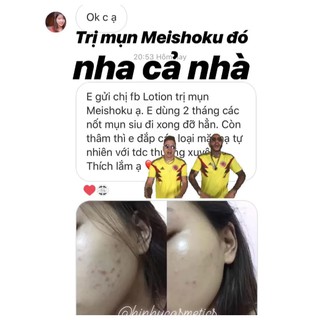 Nước Hoa Hồng Meishoku
