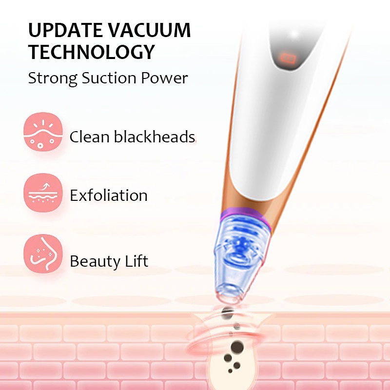 Máy hút mụn đầu đen SUAKE làm sạch lỗ chân lông chạy điện tiện dụng