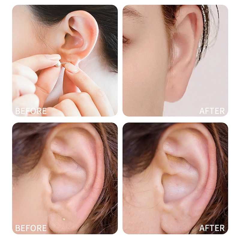 Bộ 70 dụng cụ vệ sinh lỗ tai dùng một lần tiện dụng