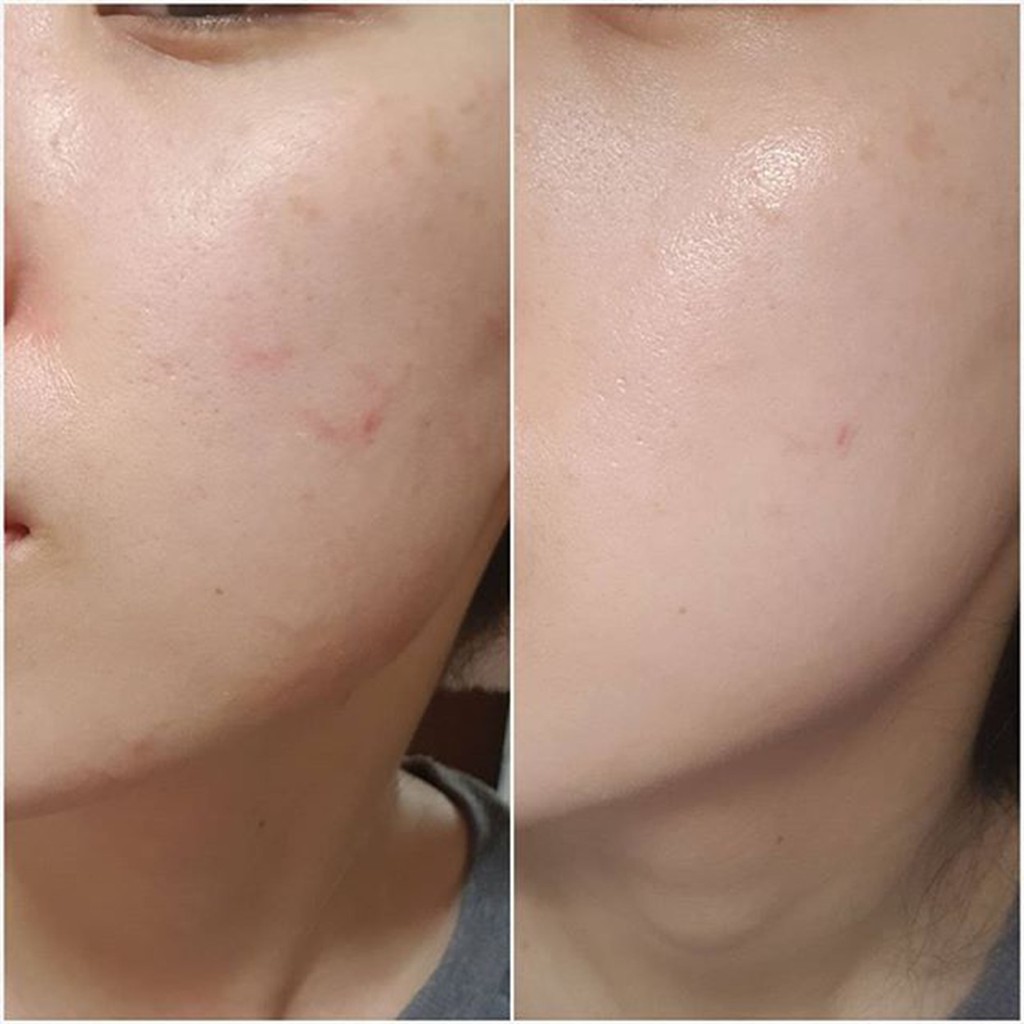Kem Chống Nắng Dưỡng Da, Ngừa Mụn Skin1004 Madagascar Centella Air-fit Suncream Plus SPF50+ PA++++