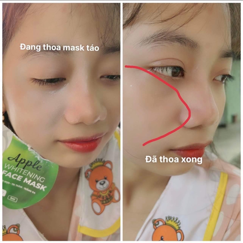 Ủ trắng Face cấp tốc CHẢNH SKIN gói 5ml- hàng chính hãng / an toàn cho da nhạy cảm