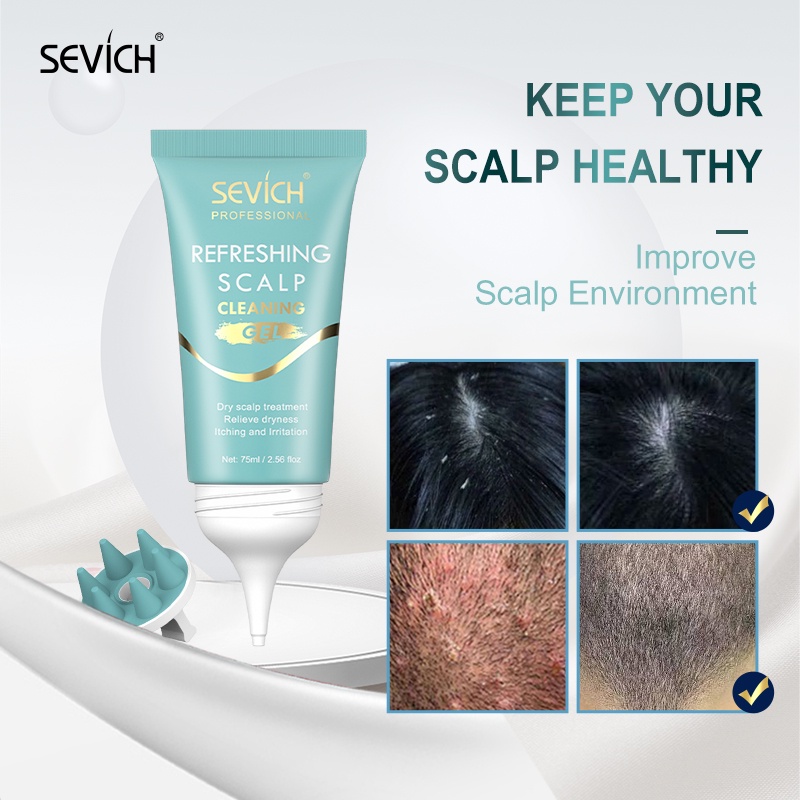 Gel làm sạch da đầu SEVICH kiểm soát dầu không gây kích ứng 75ml