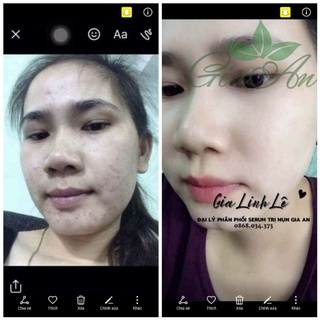 Serum Gia An