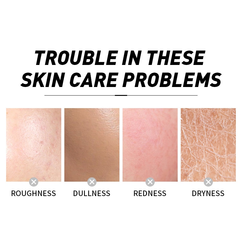 Nước Hoa Anh Đào LAIKOU 100ml Nuôi Dưỡng Làm Trẻ Hóa Làn Da