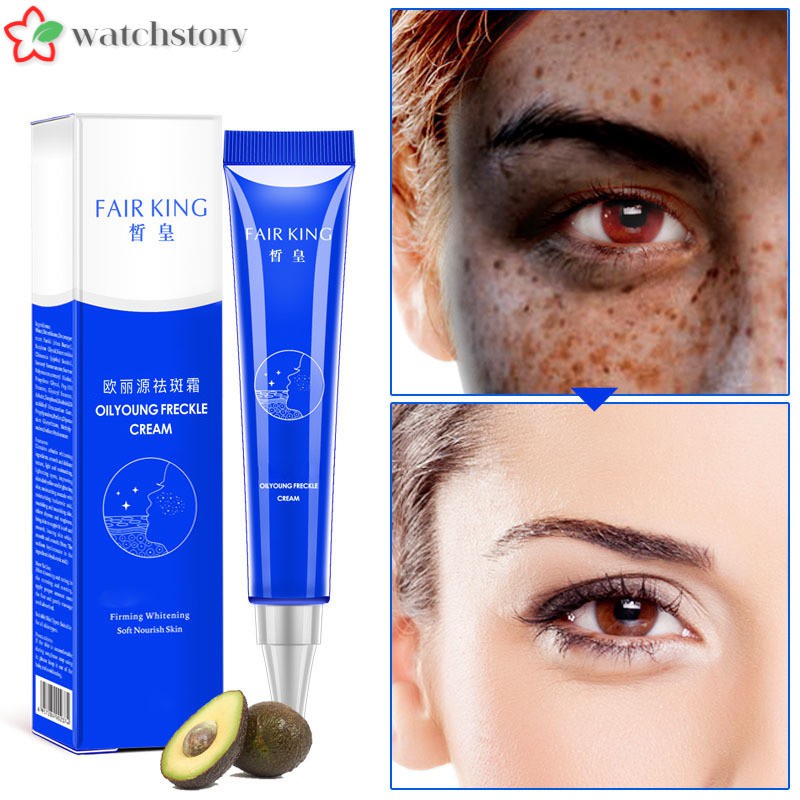 (Hàng Mới Về) Kem Trị Tàn Nhang Vết Thâm Làm Trắng Da 20g | BigBuy360 - bigbuy360.vn