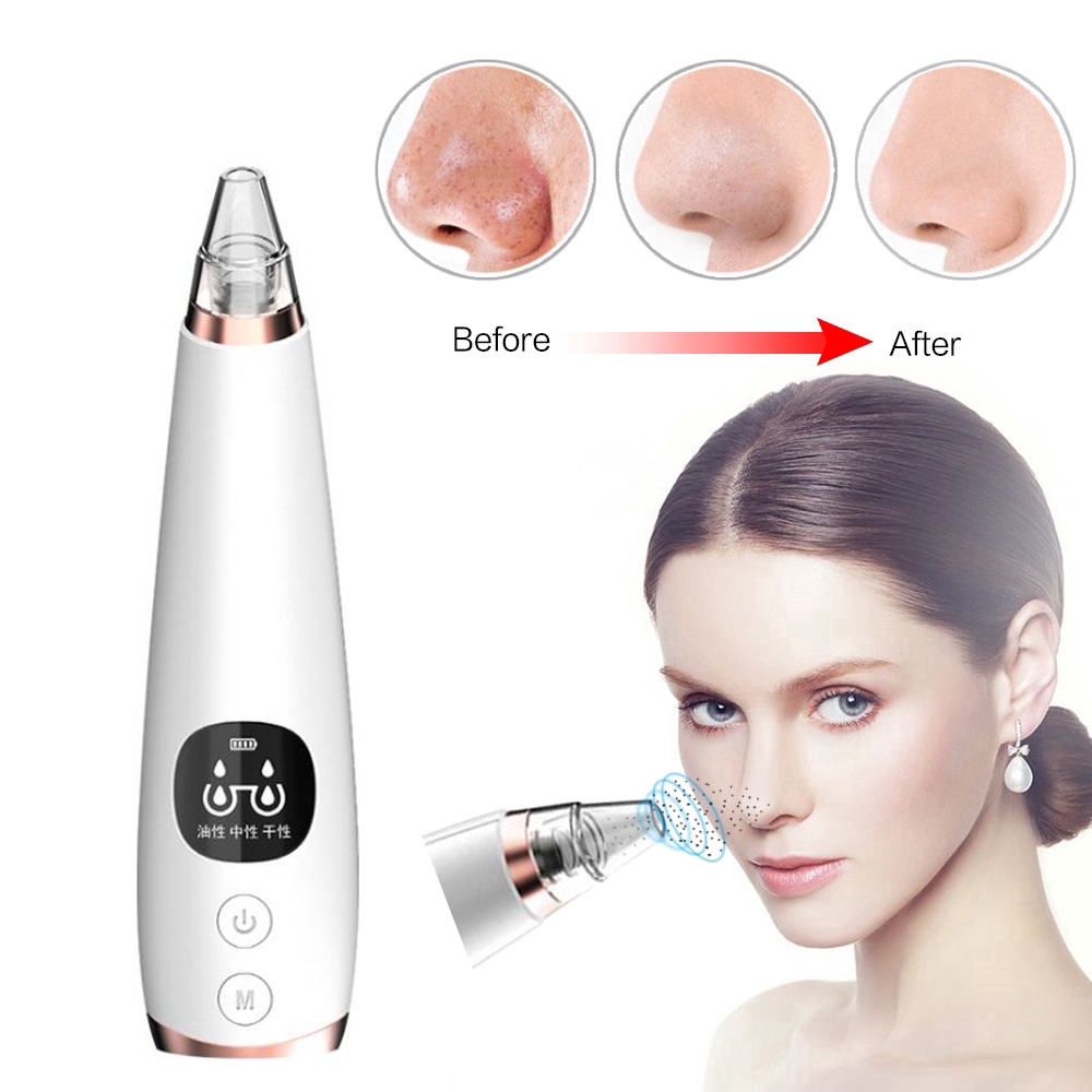 Máy Hút Mụn Đầu Đen Suolaer Vệ Sinh Mặt Hiệu Quả