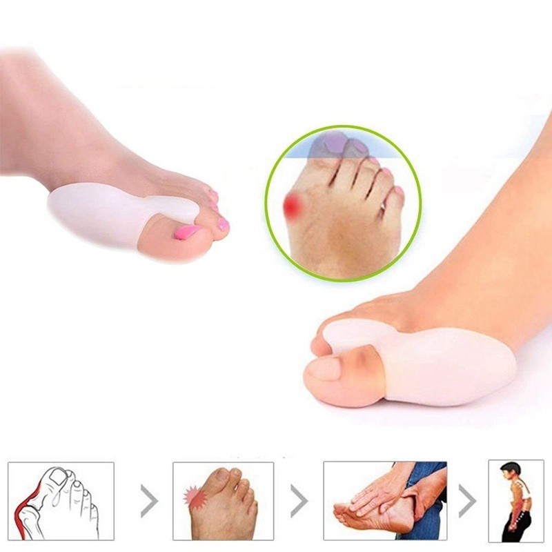 Set 2 miếng silicone bảo vệ ngón chân cái tránh bị đau khi mang giày
