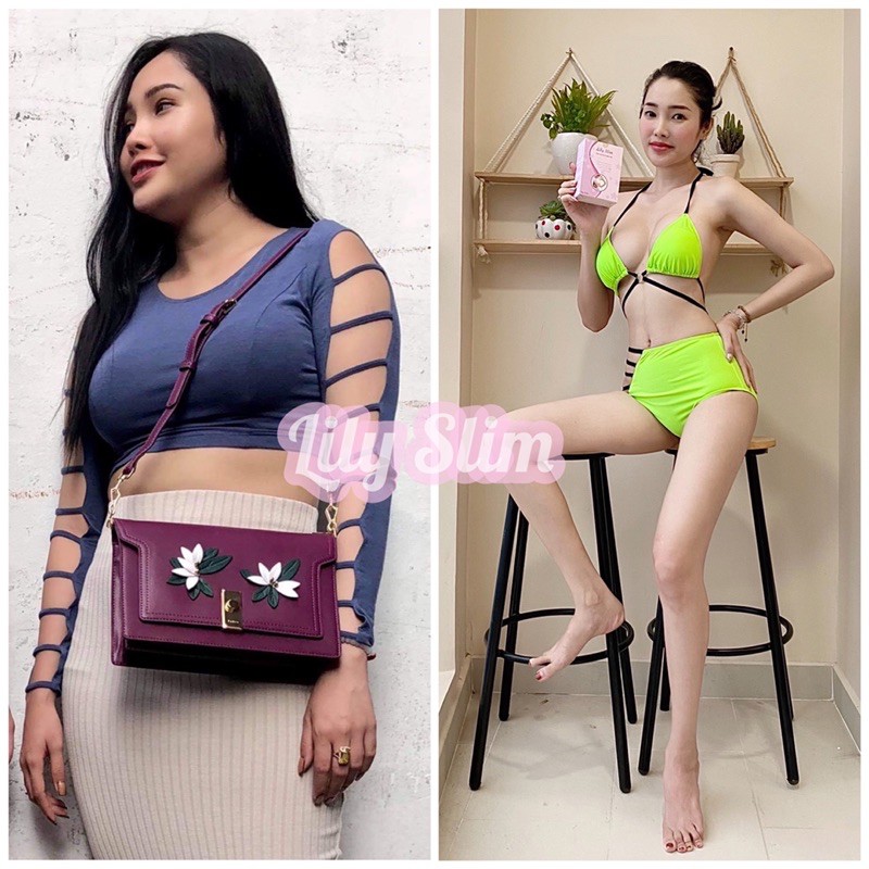 Giảm cân Lily Slim