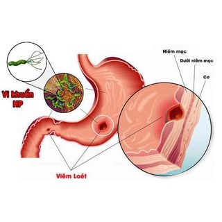 VIÊN DẠ DÀY TÁ TRÀNG METAHERB