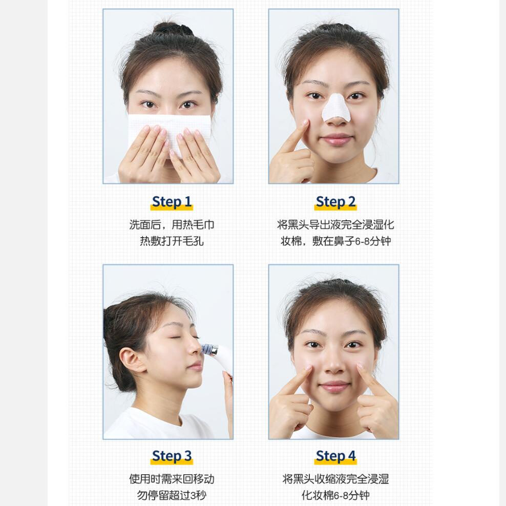 Máy Hút Mụn Đầu Đen Làm Sạch Lỗ Chân Lông Hiệu Quả