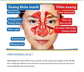 Vua Xoang Dfoli