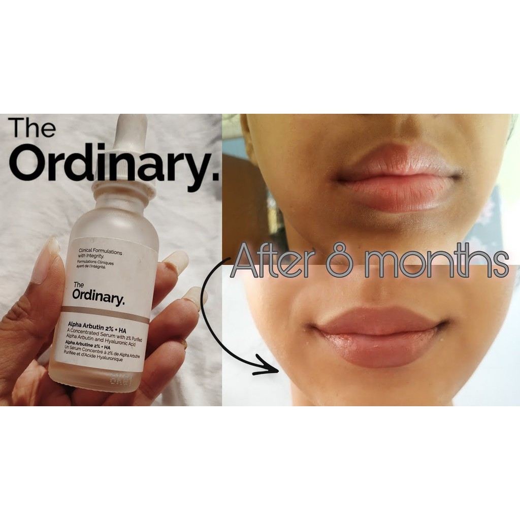The Ordinary Alpha Arbutin 2% + HA Hyperpigmentation Serum trắng da, mờ thâm 30mil TOTO shop