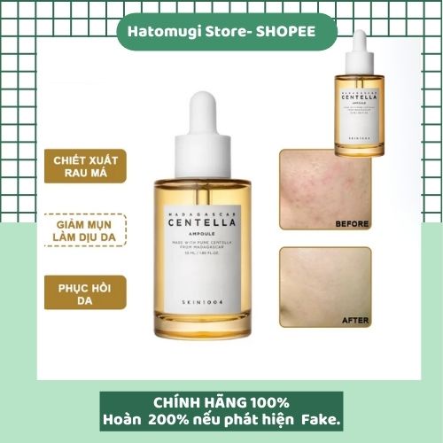 [Sạch mụn 100%_Hàng A.uth] Tinh Chất Skin1004 Madagascar Centella Ampoule Giảm Mụn Và Làm Dịu Dành Cho Da Nhạy Cảm  55ml