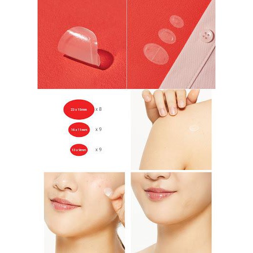 [Chính Hãng 100%] Miếng Dán Mụn Cosrx Acne Pimple Master Patch