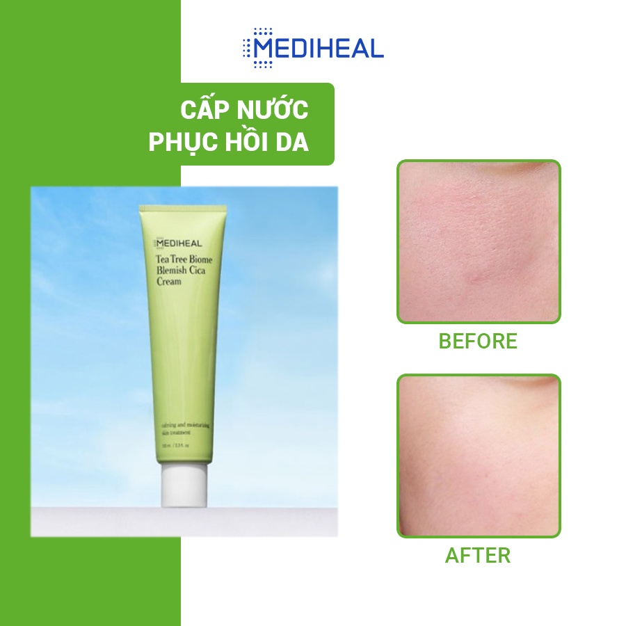 Kem Dưỡng Chiết Xuất Tràm Trà Và Rau Má Dành Cho Da Nhạy Cảm Mediheal Tea Tree Biome Blemish Cica Cream 100ml