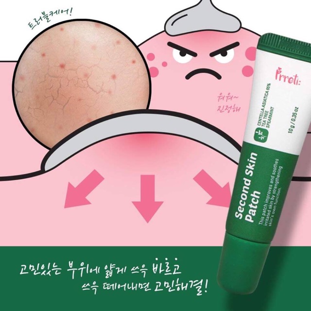 Gel dán mụn thần thánh Prreti Second Skin Patch 10g