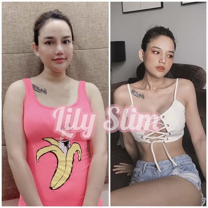 Thuốc Giảm Cân Lily Slim Hộp 30 Viên Hỗ Trợ Giảm 3-10Kg Không Tác Dụng Phụ