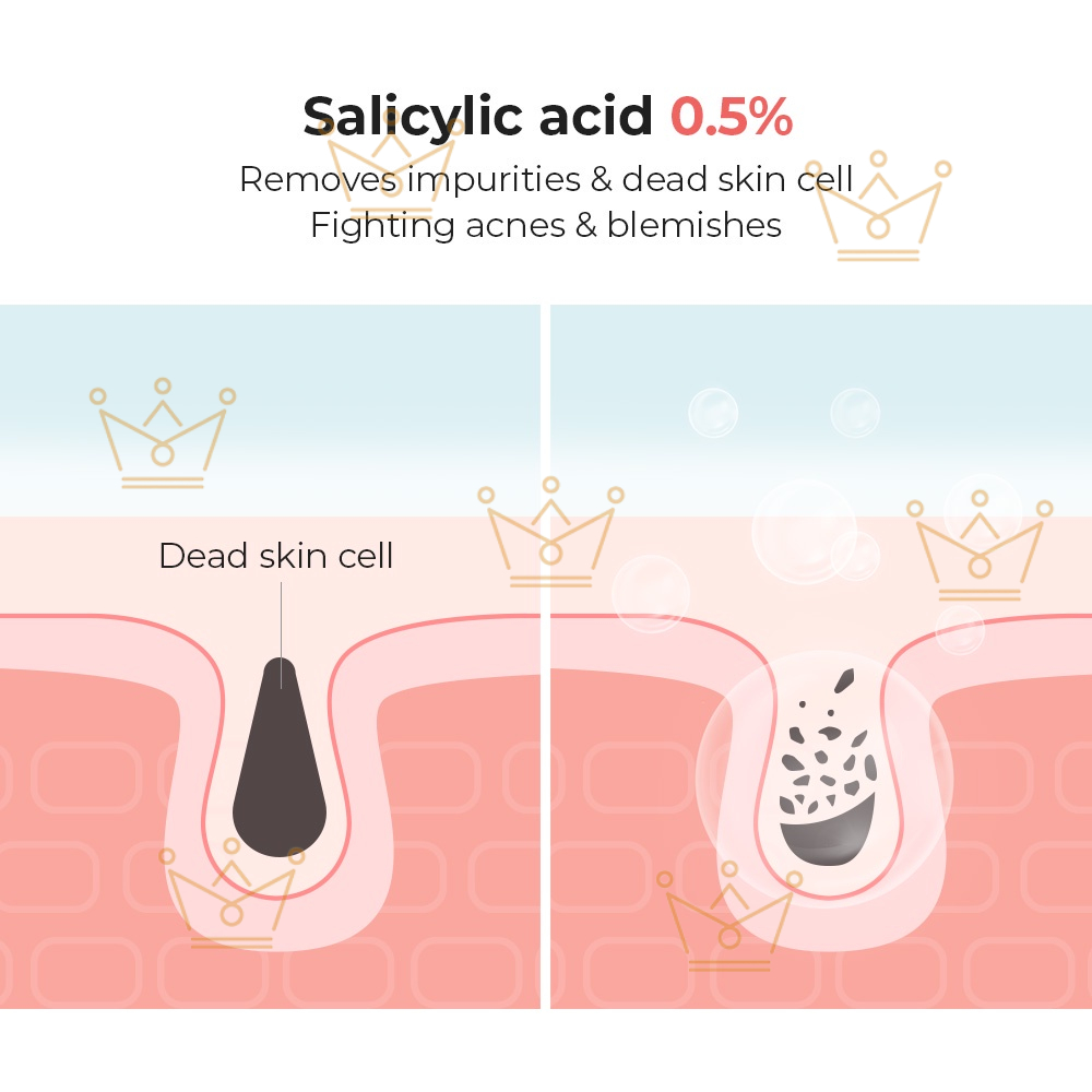 Sữa rửa mặt COSRX Salicylic Axit 0.5% 150ml tái tạo da hiệu quả