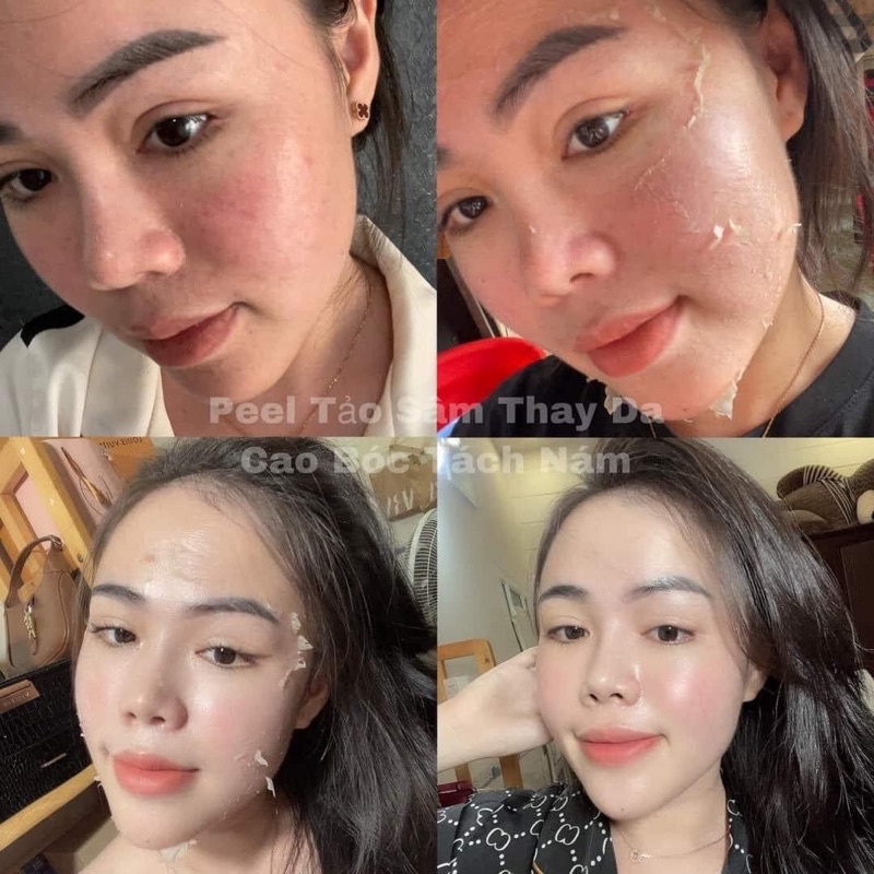 Ủ trắng lúa mạch NICOS 20g chính hãng 100%