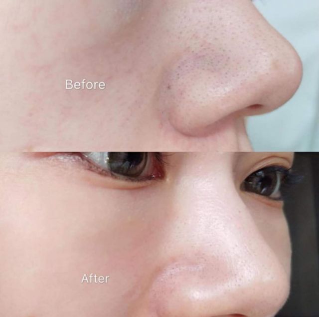 Nước hoa hồng LaboLabo Super Keana Lotion 100ml | BigBuy360 - bigbuy360.vn