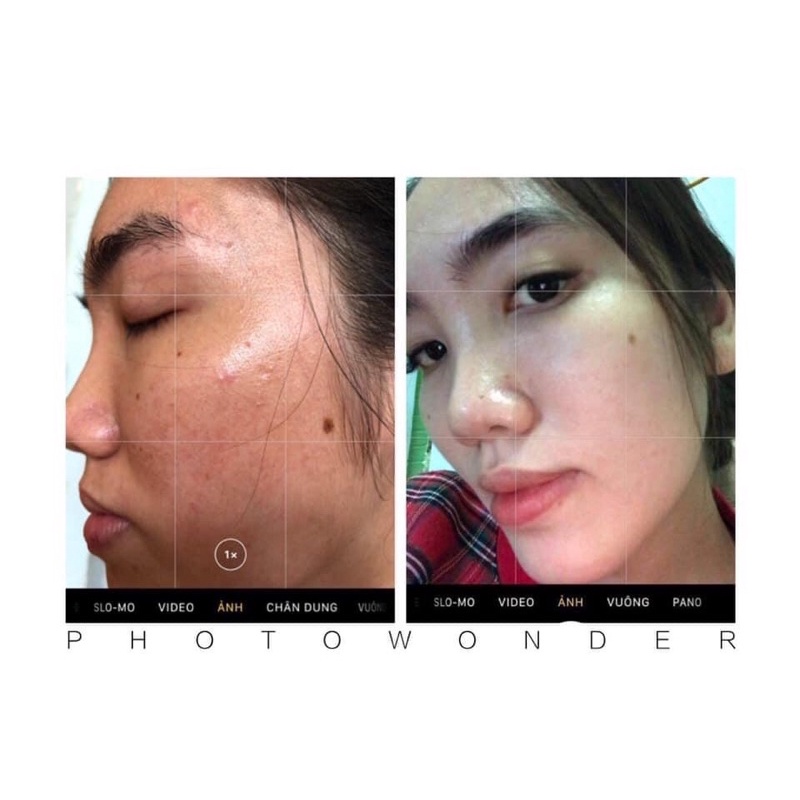 KEM TÁI TẠO DA ĐÔNG Y | BigBuy360 - bigbuy360.vn