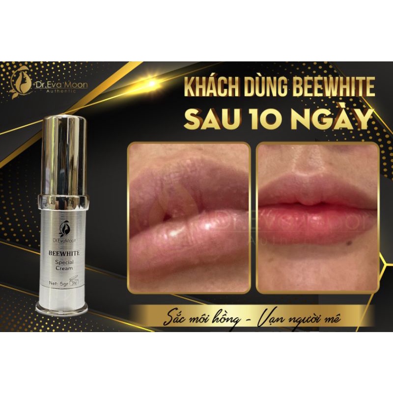 Làm Hồng nhũ hoa, hồng vùng kín, hồng Môi BeeWhite