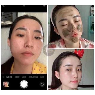 [Chính Hãng] SỮA RỬA MẶT ĐÔNG Y NICOS