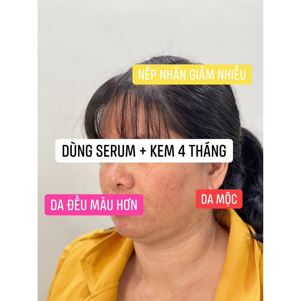 SHOP HIỀN - KEM TRỊ MỤN | BigBuy360 - bigbuy360.vn