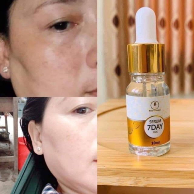 Serum Truyền Trắng 7 Days Olic 10ml - [ Hàng Chuẩn Cty ] | BigBuy360 - bigbuy360.vn