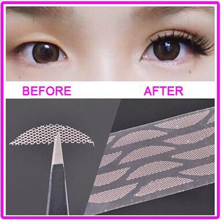 Kích mí lưới (hộp)