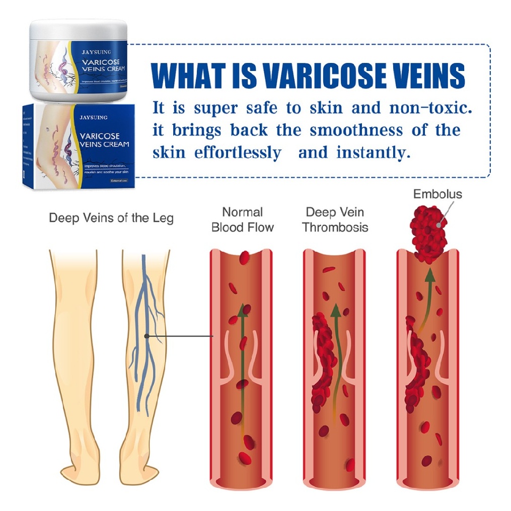 50g Vein Care Fading Cream Varicose Veins Cream for Legs Veins Herbal Ointment