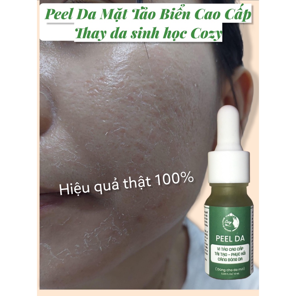 Peel da mặt vi tảo biển COZY - tẩy da chết thay da sinh học cho mặt - Pell lột da mặt - tái tạo da mờ thâm nám