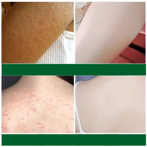 Tẩy da chết body 250g tẩy tế bào chết cơ thể YZKMSKIN làm trắng da toàn thân Làm cho da mịn màng và mềm mại | BigBuy360 - bigbuy360.vn