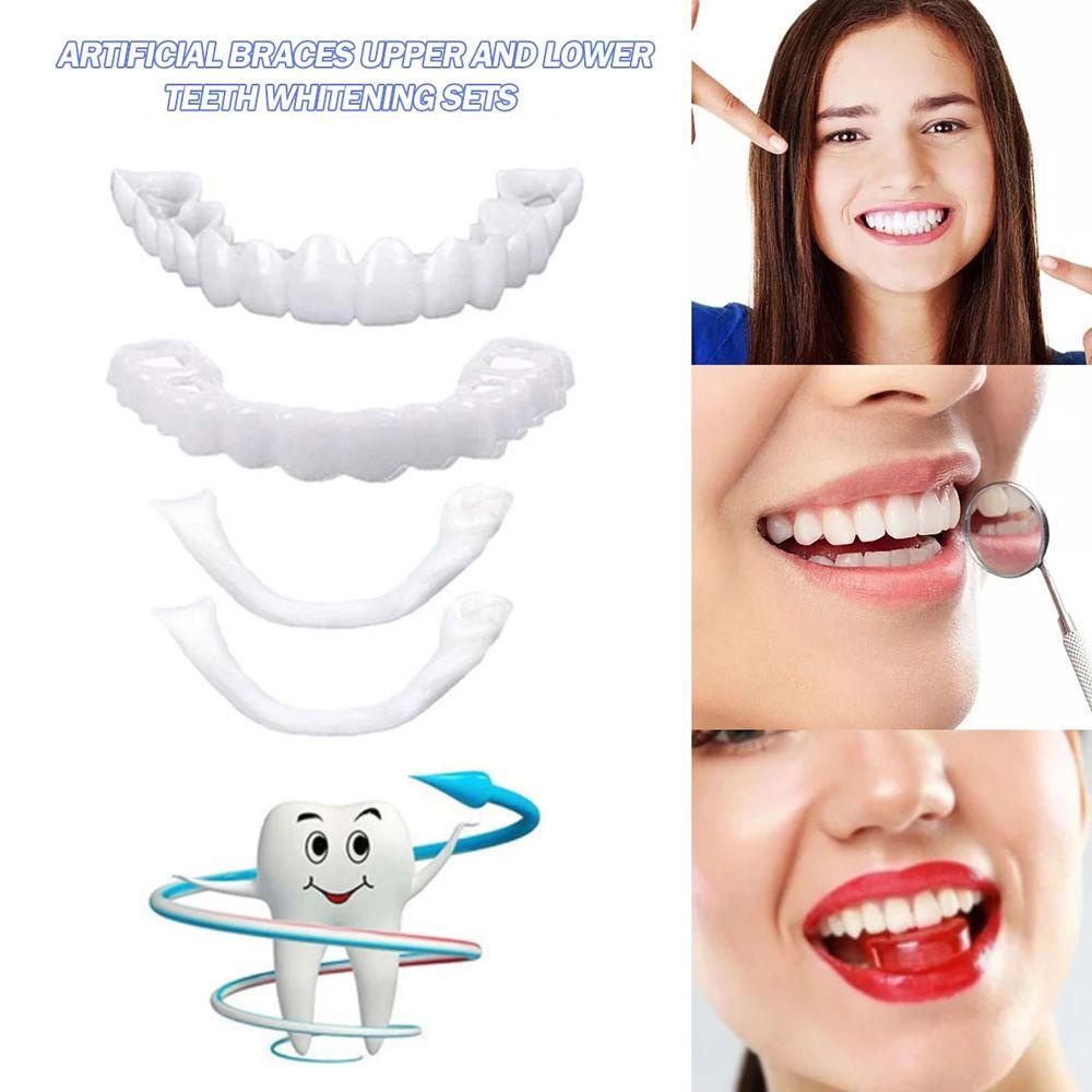 Glenes Vỏ Bọc Niềng Răng Giả Tạm Thời Tiện Dụng Cho Nam Và Nữ