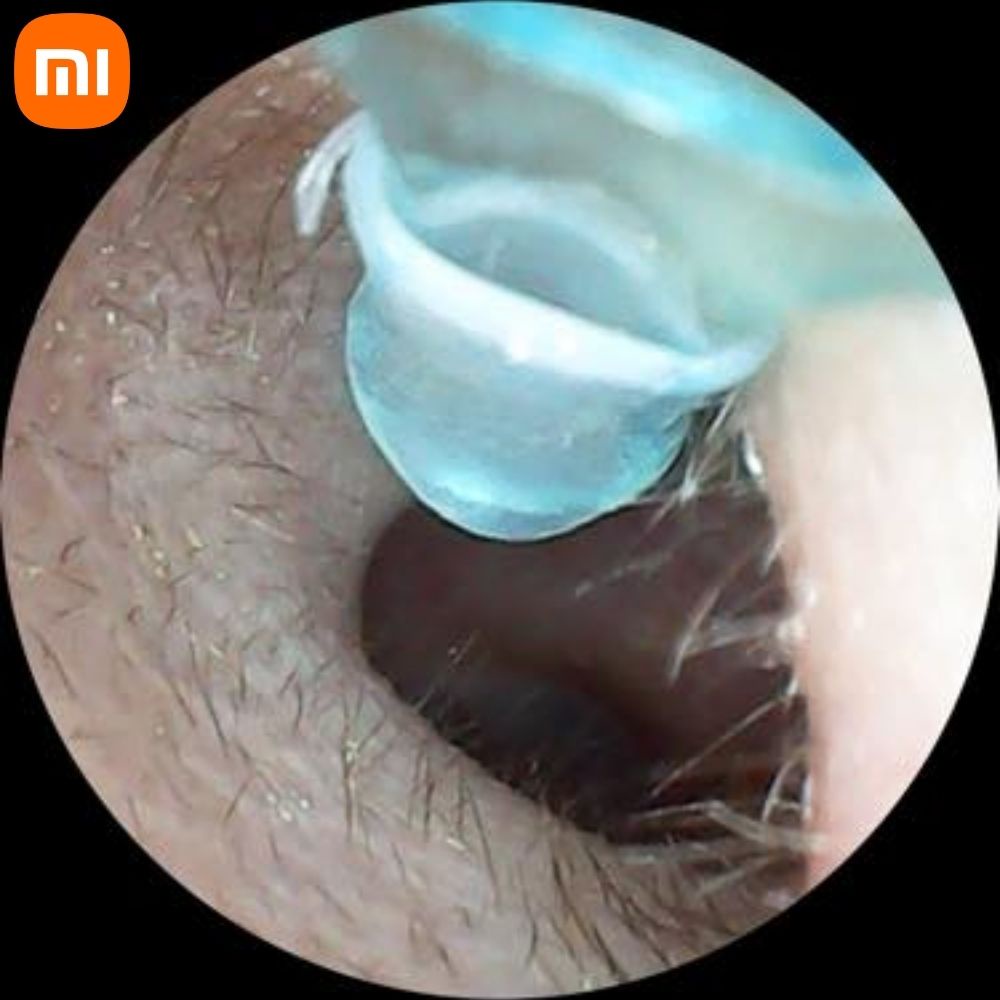Dụng cụ lấy ráy tai Xiaomi Bebird R1, nội soi bằng camera siêu nét kết nối điện thoại