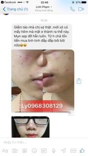 Toner giấm táo