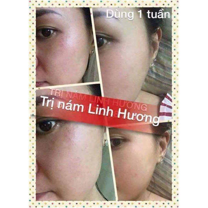 Tinh Chất Nám Linh Hương Ngăn Ngừa Nám và Lão Hóa Da 10ml