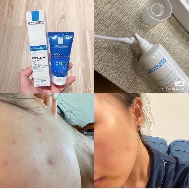 Set Kem dưỡng giảm mụn, giảm vết thâm và ngăn mụn tái phát La Roch Posay Effaclar Duo+ 40ml