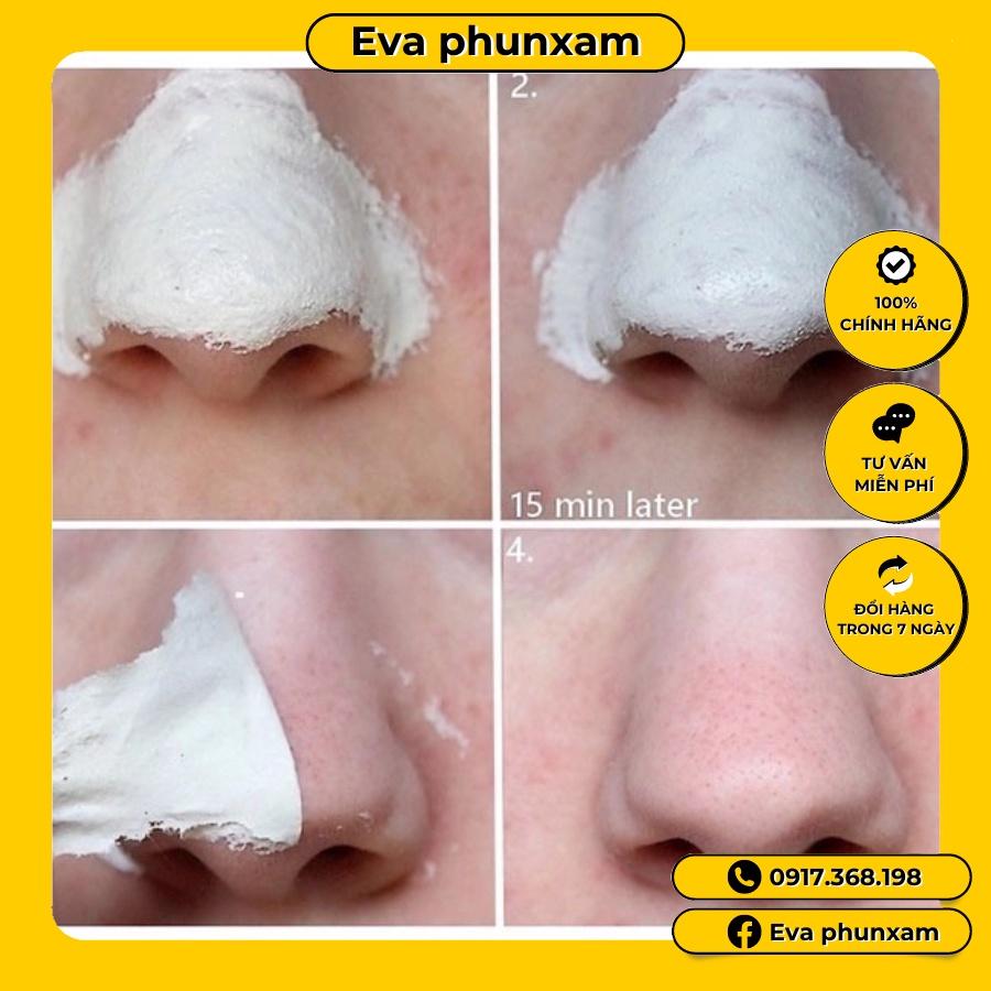 Gel lột mụn đầu đen, mụn cám handmade siêu dính