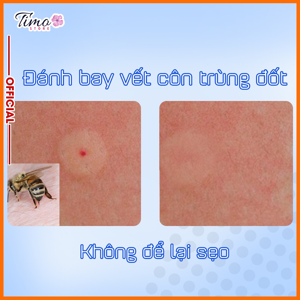 Kem mờ sẹo lồi lõm, thâm sẹo Klirvin 25ML giúp mờ sẹo trong 2 tháng hàng Nga chính phẩm | TM015