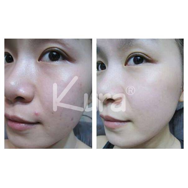 Kem Dưỡng Da Cao Cấp - Kura Beauty Face (3in1) | BigBuy360 - bigbuy360.vn