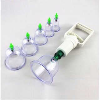 Bộ giác hơi 12 món không dùng lửa