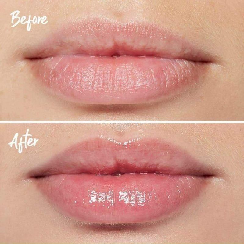 Son Dưỡng Làm Căng Đầy Môi TEOXANE 3D LIP 10ML